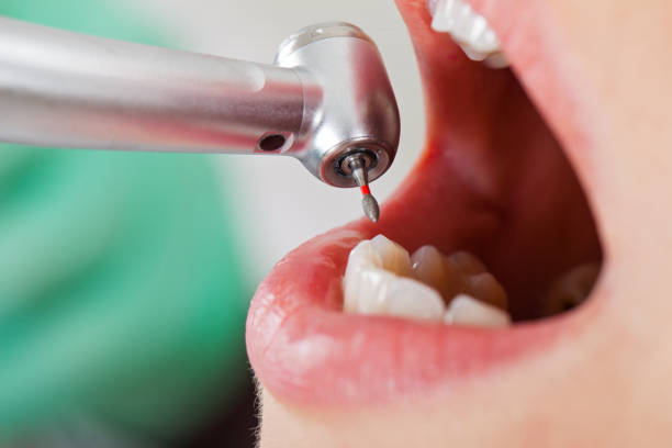 Best After-Hours Emergency Dentist in South Cleveland, TN